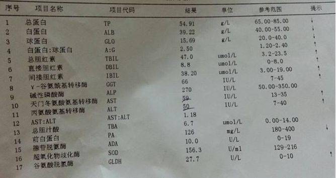 肝功能检验单上总蛋白高了背后的这些原因