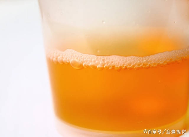 肝脏|27岁女老师大便异样，医生：肝已“硬如石头”，这种“汤”别喝了