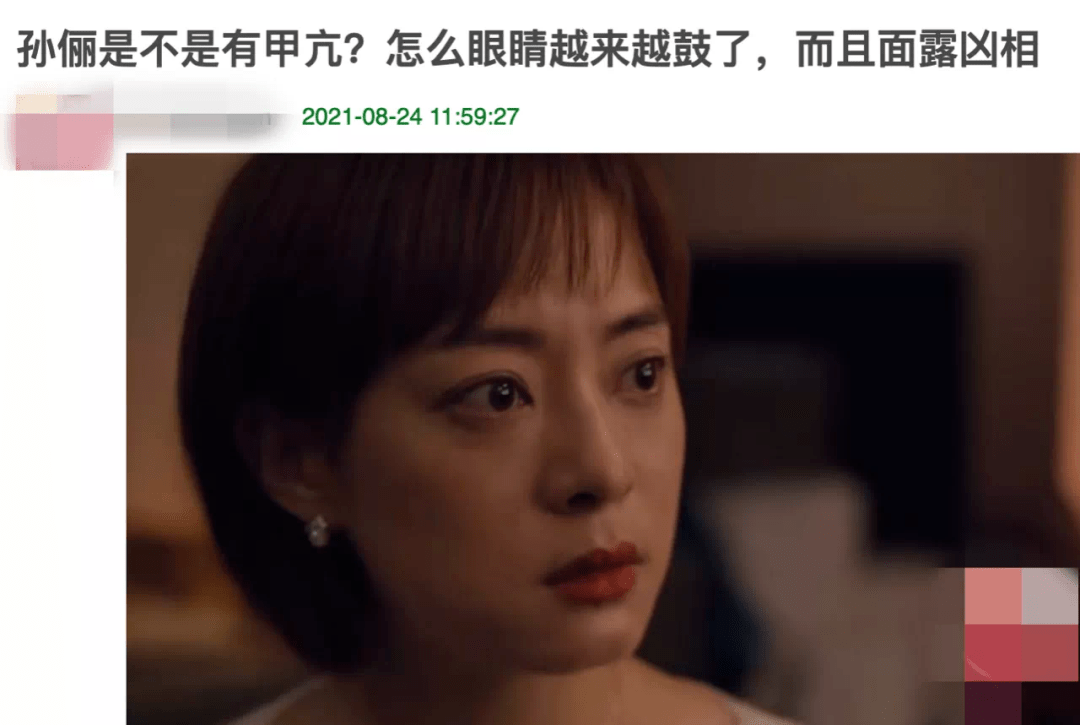 眼睛越来越鼓,面相愈发凶悍.目露凶光,疑似甲亢.