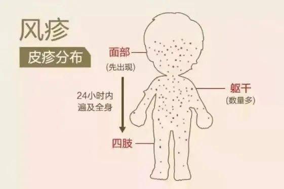 【保健之窗】五一幼儿园秋季传染病防控知识宣传_病毒