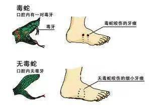 辨蛇 迅速拨打急救电话120.注意,千万不要