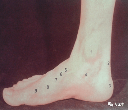 内踝 2.跟腱 3.跟骨结节 4.载距突 5.舟骨粗隆 6.内侧楔骨 7.