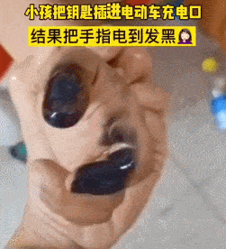 小孩如此操作,手被烧黑!_充电