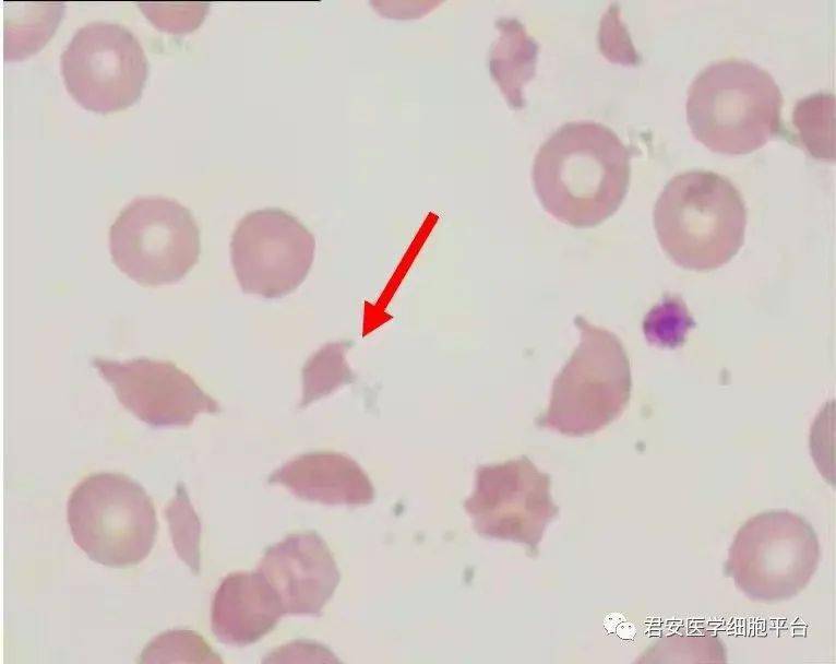 请报告箭头所指"细胞"名称编码 血涂片 瑞士—吉姆萨染色 1000× 中性
