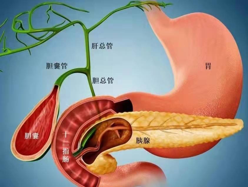 八旬老太患上胆管结石,医生不开刀就为其取出