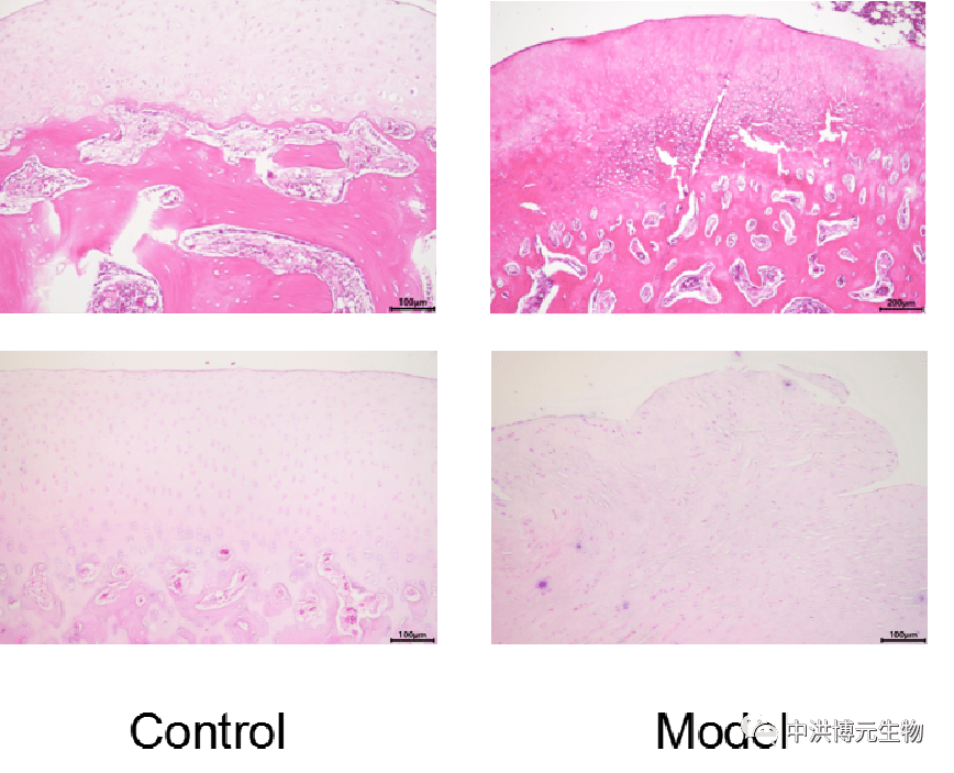 诱发性骨性关节炎模型oa