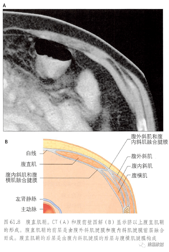 外斜肌腱膜两层的概念腹股沟管的深层结构↓ 内容节选自:《格氏解剖学