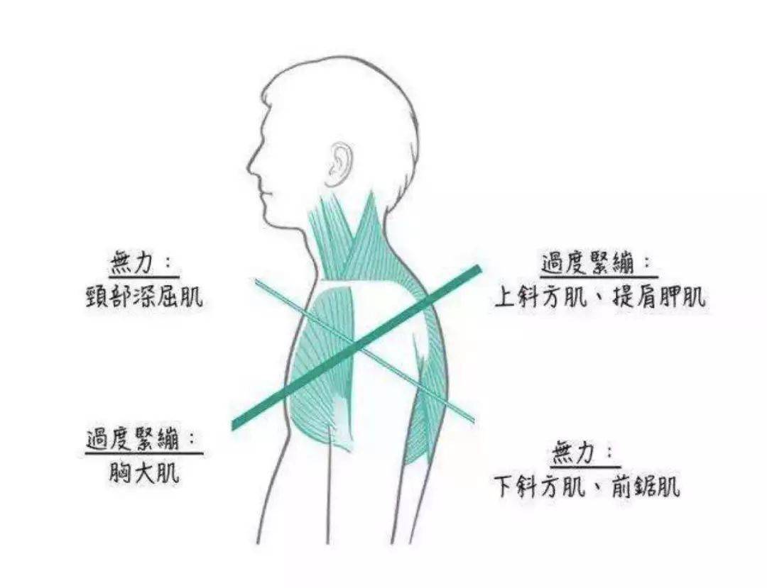 运动康复来帮忙_骨盆_韧带_姿势