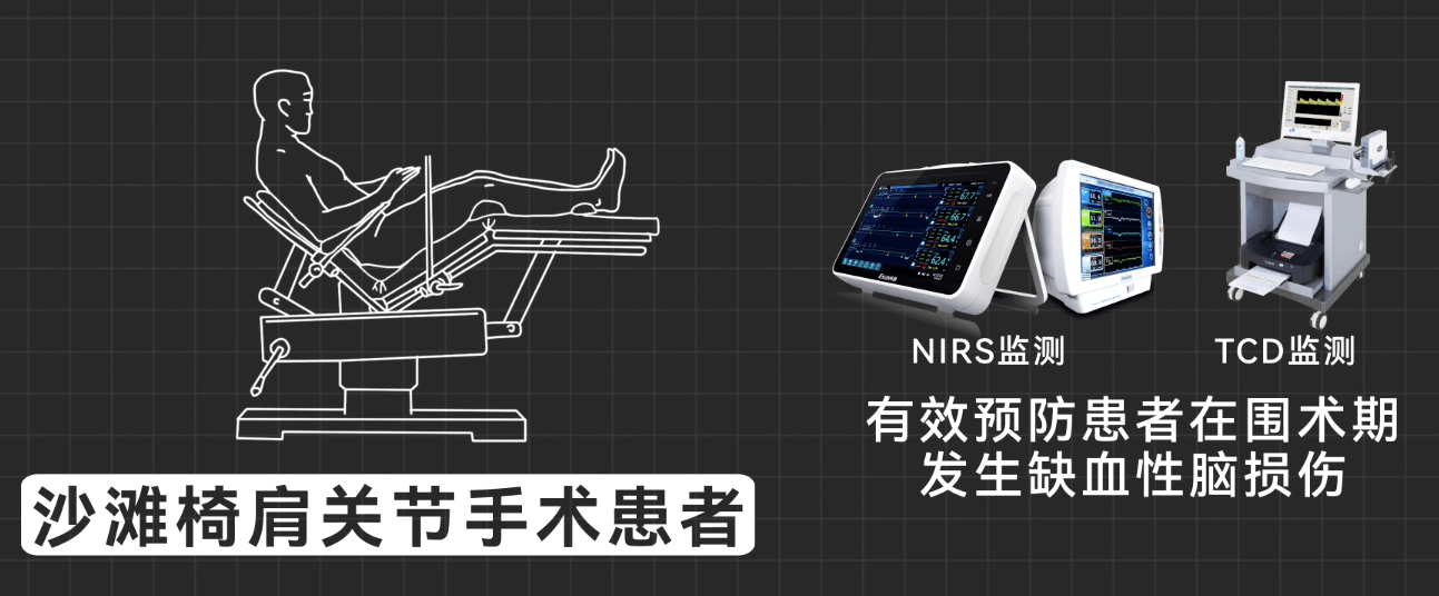 nirs,tcd监测 沙滩椅位肩关节镜下肩袖修补手术_患者_变化_mmhg