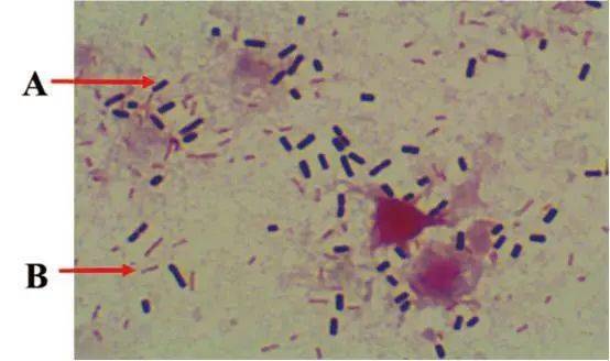 肺脏触片经革兰氏染色可见优势菌,革兰氏阳性粗壮杆菌,两头钝圆