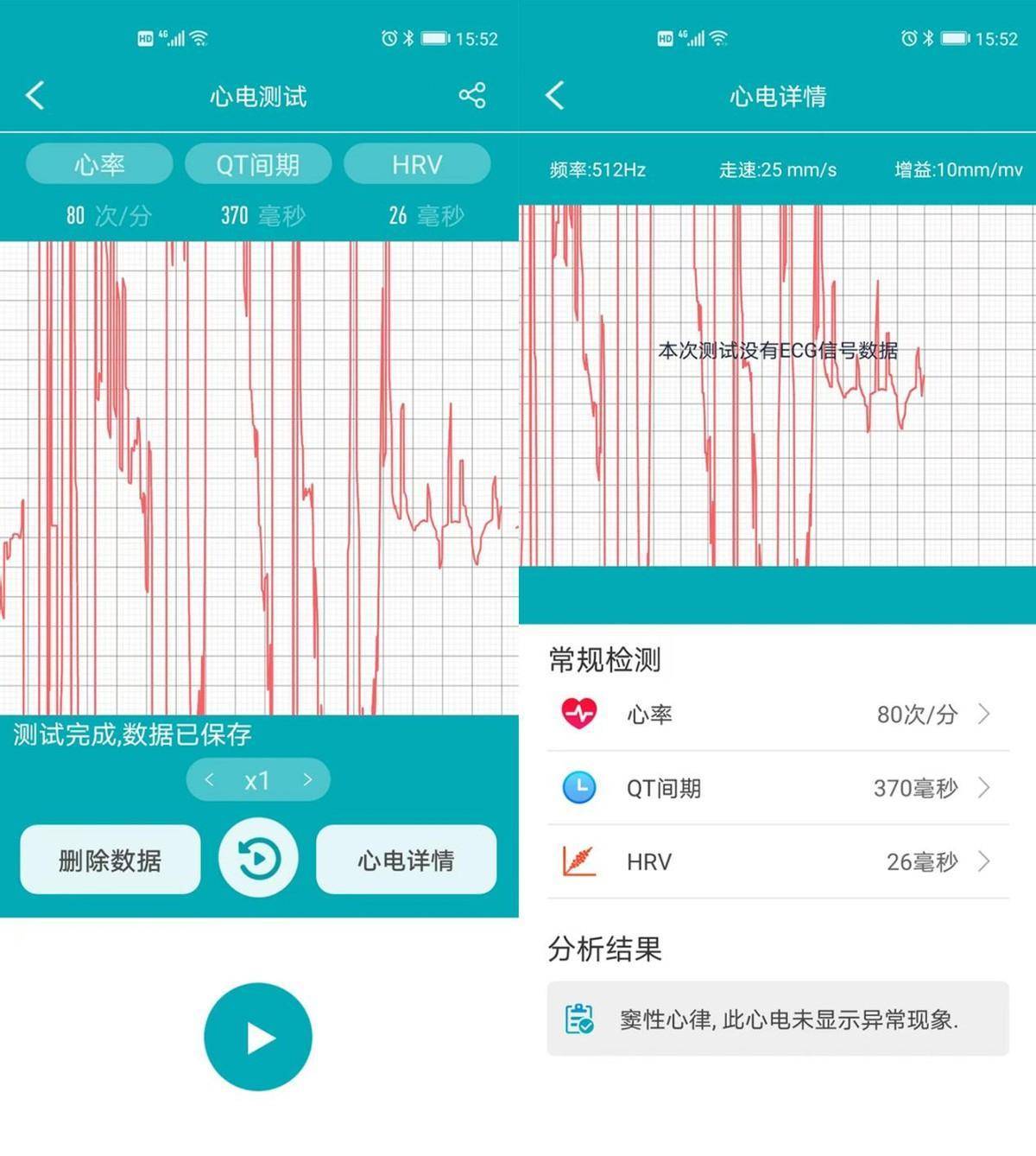 ��Ƚ����˶�����������dido G28S Pro�����˵ĵ�һ֧���� ...