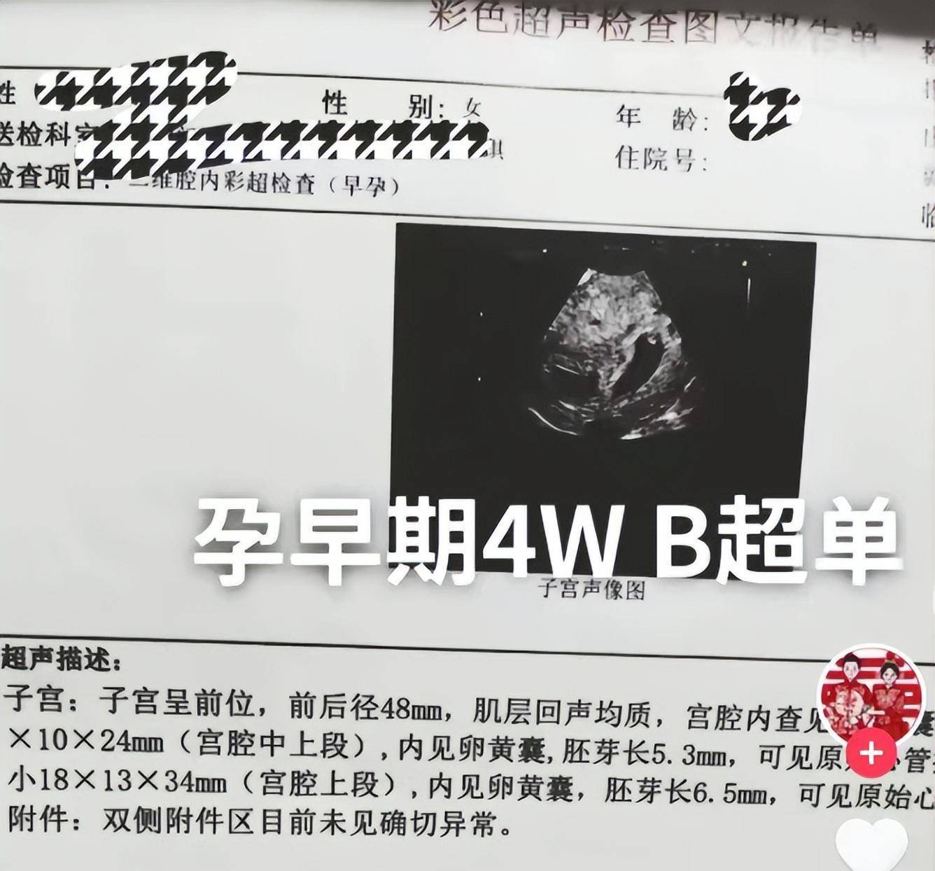 大衣哥的准儿媳陈梦b超,怀孕8周,双胞胎_陈亚男_孩子_婚姻