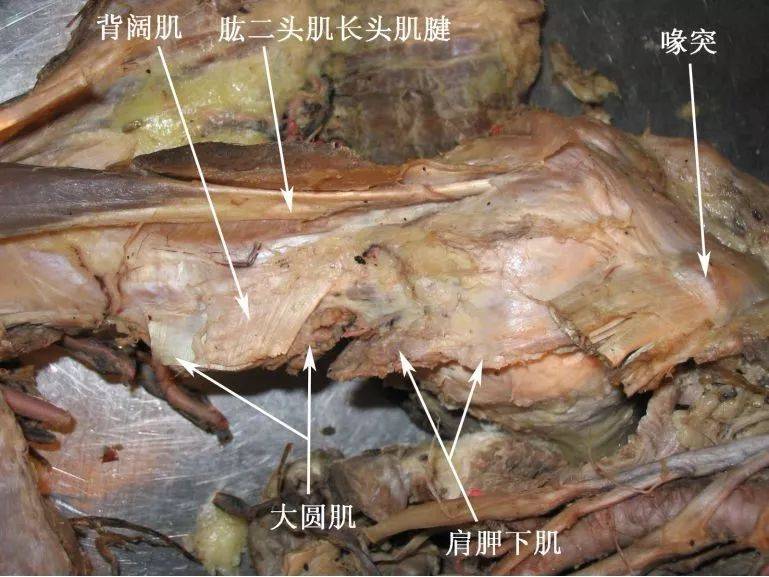 外层肌袖为三角肌,包围肩关节的前,外,后三面;内层肌袖为肩胛下肌,冈