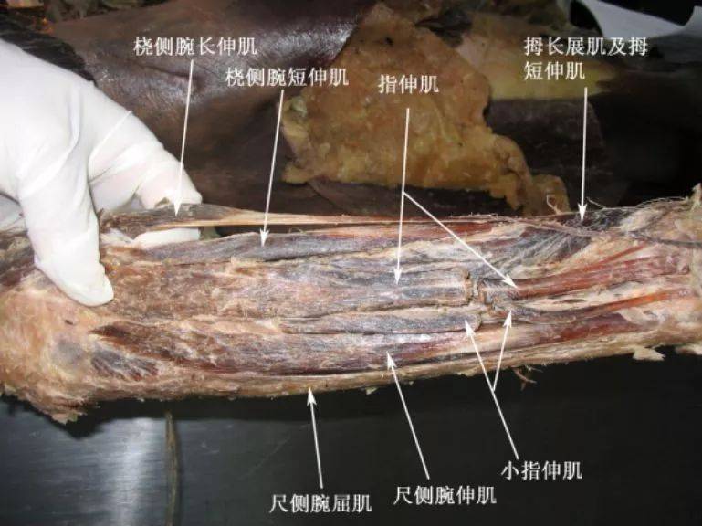 前臂肌后群:共10块,分为两层.