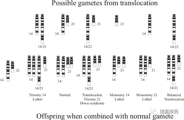 21号染色体及相关疾病_综合征_人类_体细胞