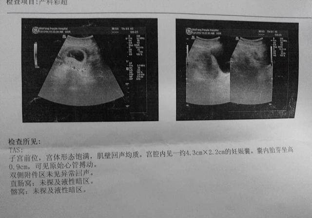 再加上每次她都研究b超单,更加确定自己怀的是个小女孩