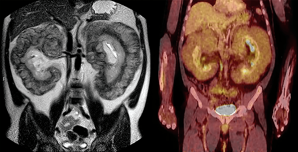 Χۣ2022ȶRadiologyѡ𺳵 ...