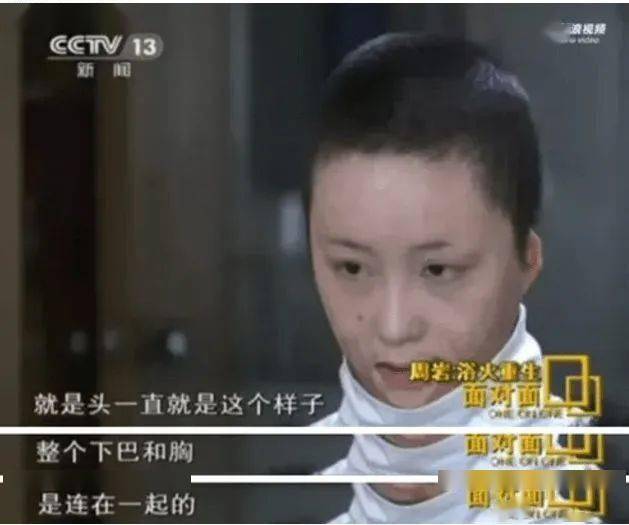 12年前，颤动全国的泼油纵火案后续来了：受害者被毁容，遭“荡妇侮辱”；凶手已出狱，竟成相亲抢手货