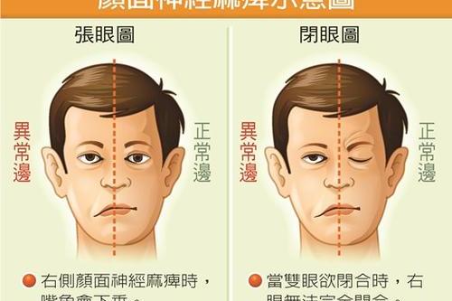 崇文门中方医院治嘴歪眼斜半边脸跳吃中药真的没有效果吗