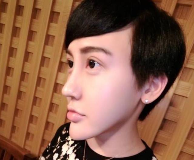 当年全网爆红的"蛇精男",下巴疑似整回原样,化身帅气小哥哥霸气归来