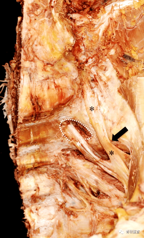 昨天 20:1600作者:inc爱恩希国际神经科学随着国人生活水平的提升