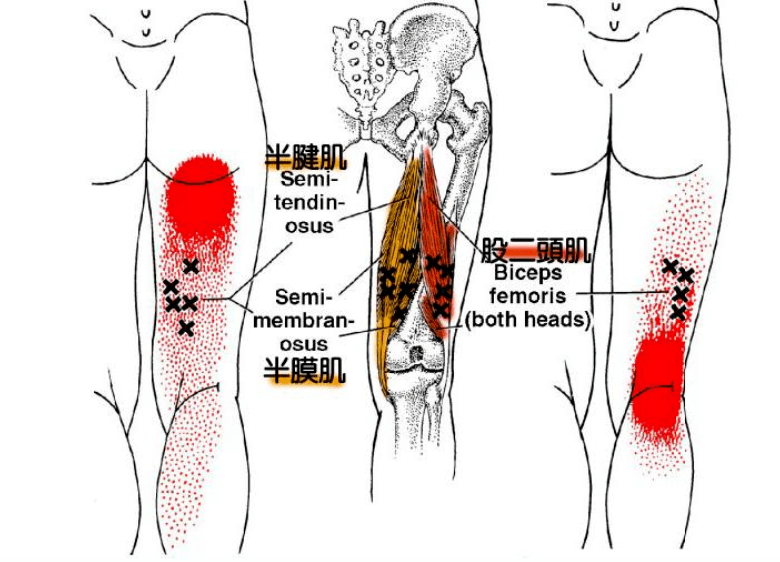 大腿后侧膝盖窝总是酸痛,与这条肌肉有关