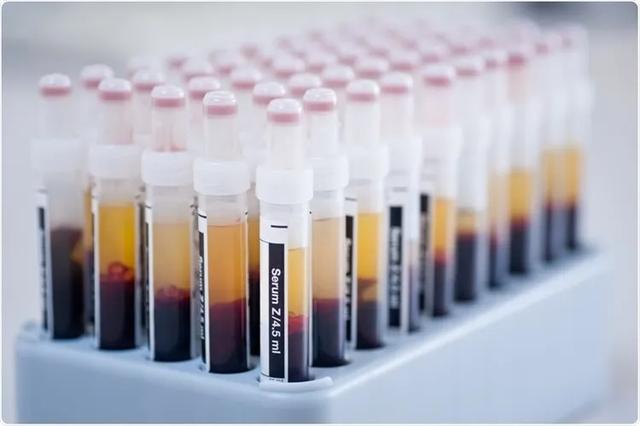 原创1毫升卖4万美元,有人把新冠康复者血浆变成了摇钱树