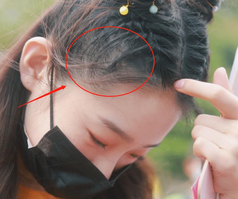 20岁张艺凡扎"小揪揪",镜头放大五倍,这个发际线确定没有看错?_头发