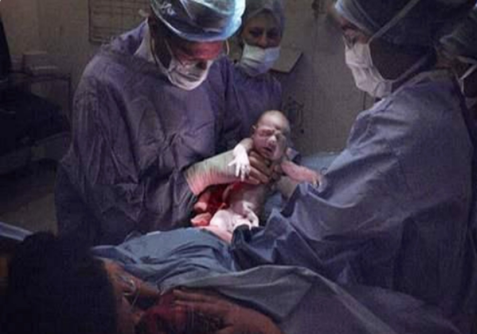 女婴 出生 下面图片