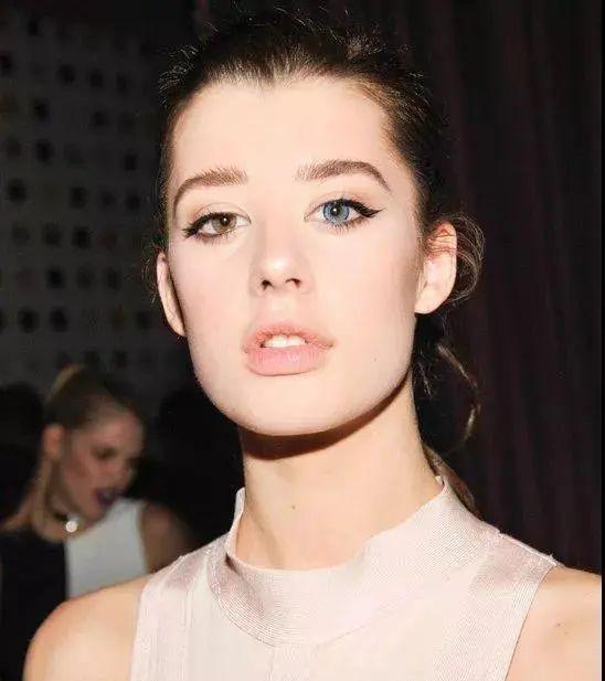 ins网红sarah macdaniel就是异瞳症患者▽异瞳症多见于猫猫身上