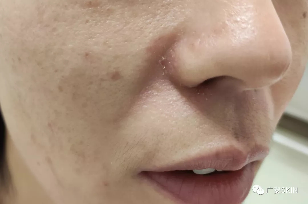 我也要"颜如玉,发如丝"—ˇ125全国护肤日