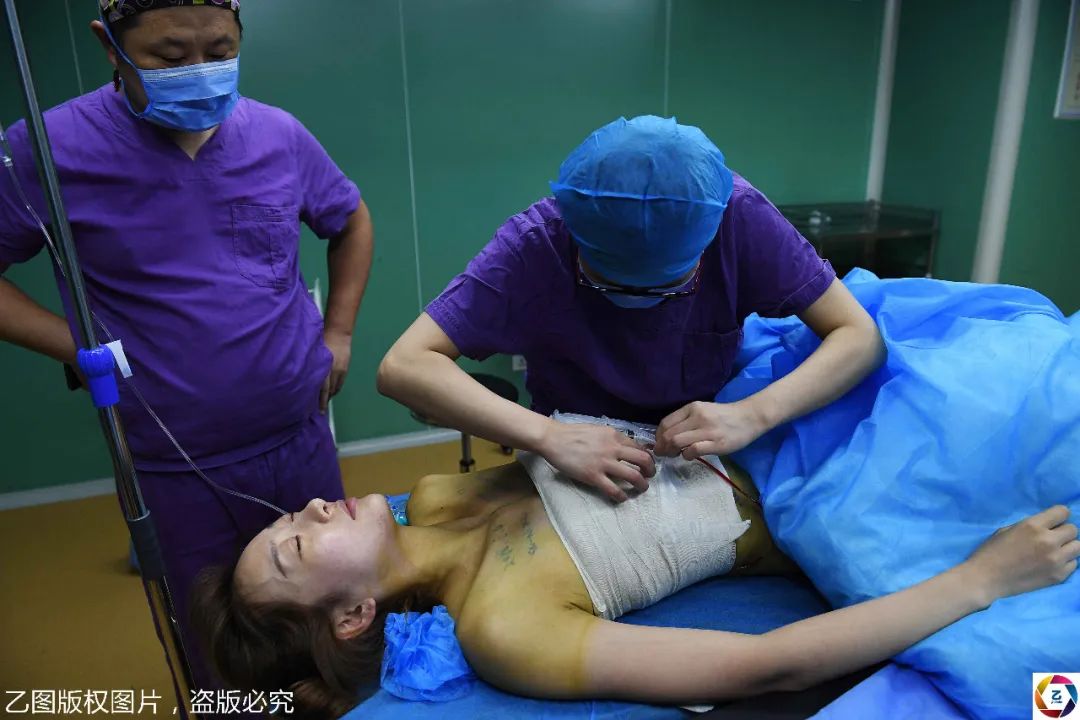 男变女手术 隆胸图片