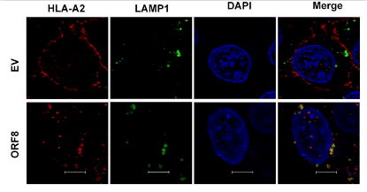 新冠病毒的 orf8 促进 mhc-i(hla-a2,红色)定位于溶酶体 (lamp1 标记