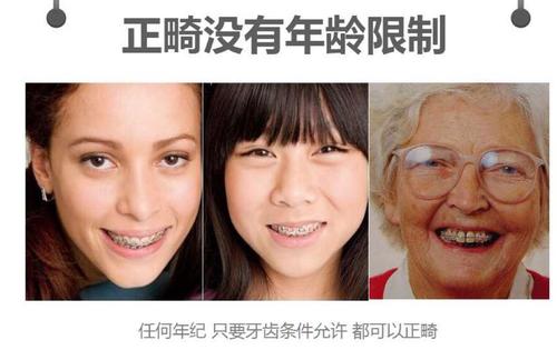 成年之后千万别整牙no正畸与年龄无关