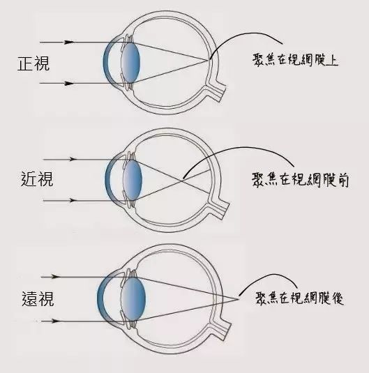 远视眼有哪些危害?