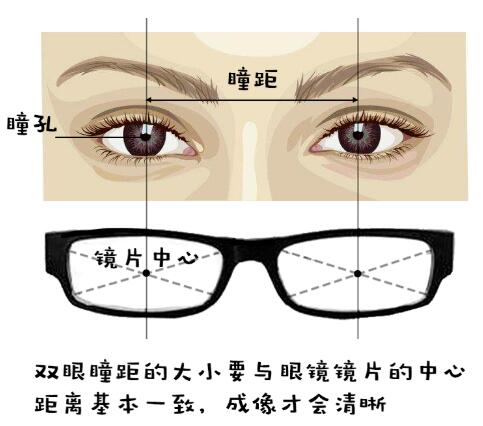你的眼镜过期了吗?荆门医学验光配镜提醒您赶快检查!