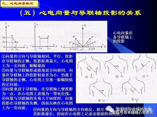 心电向量图的临床意义图片