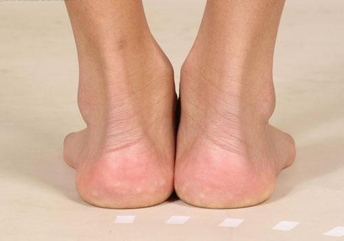 原创为什么多数糖尿病患者脚后跟都容易疼有两大原因教您如何缓解