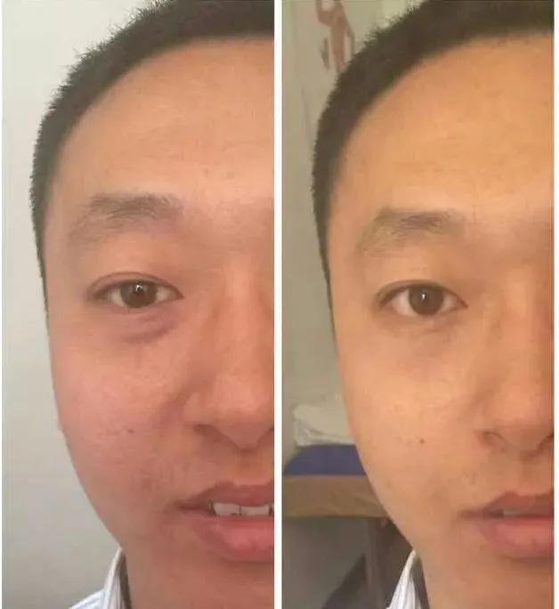 御医传人继承了皇室抗衰秘技面部美容驻颜术