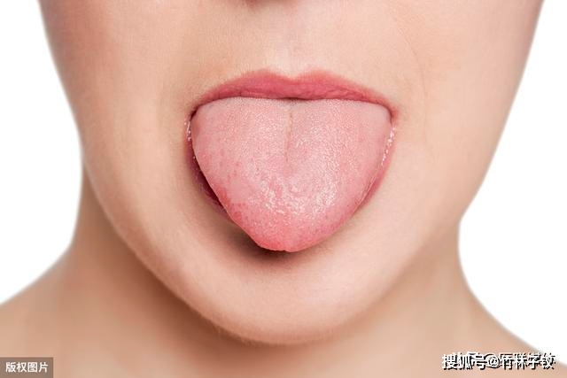 舌头出现这4个异常,或是与某些疾病有关,别不当一回事
