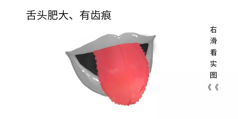 5种常见舌相学起来，出现第四种需要及时就医！_舌头