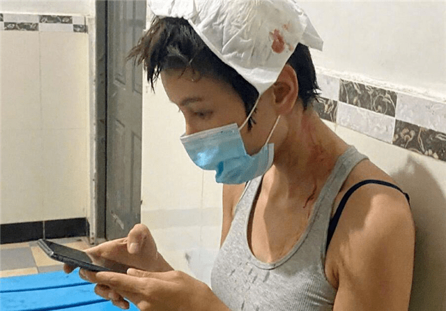 原创张蓝心拍戏头部受伤,伤口3厘米,包扎后回到剧组被赞敬业