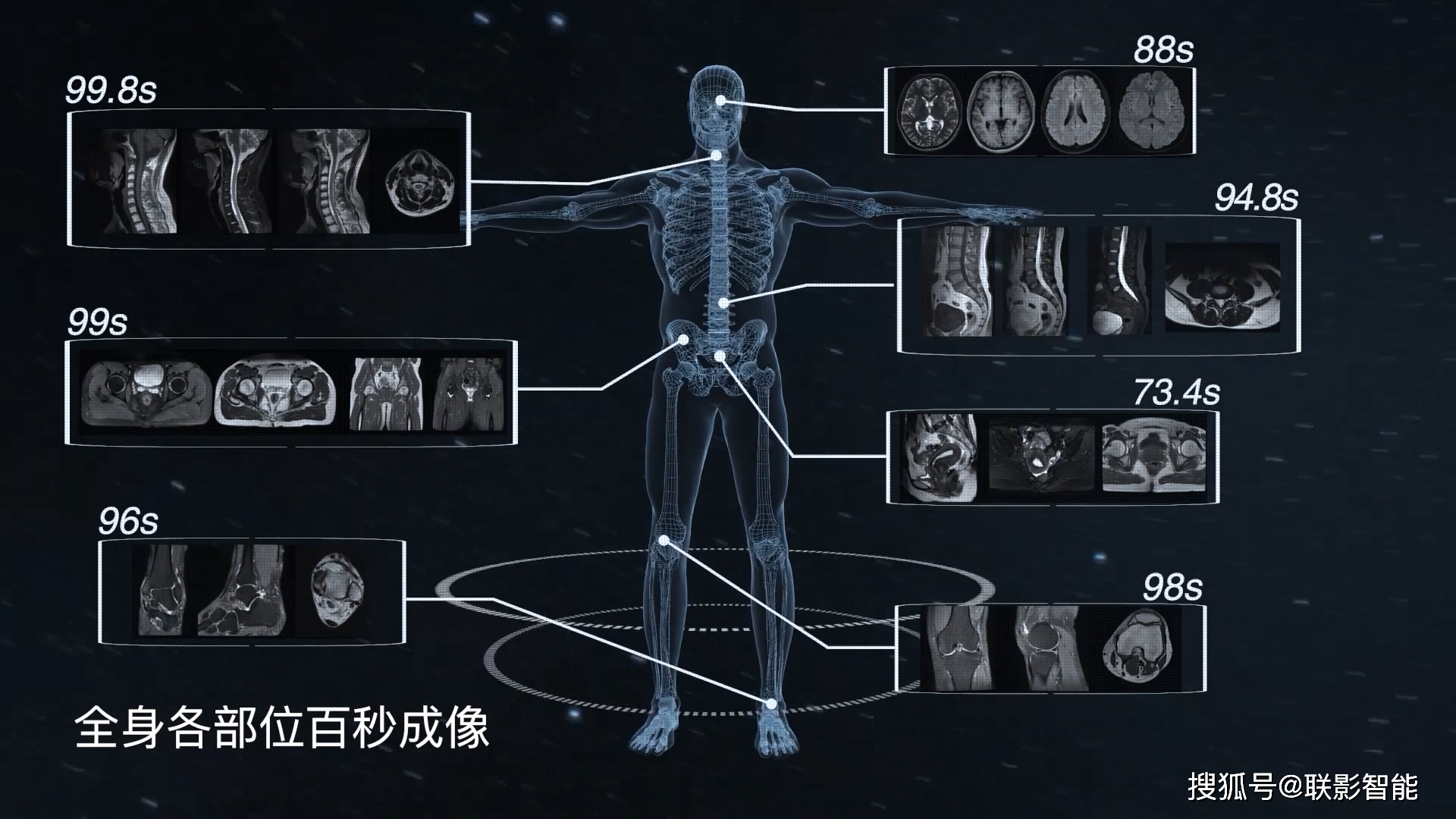 2020 waic i 联影智能ceo深度解读"后疫情时代"医疗ai机遇