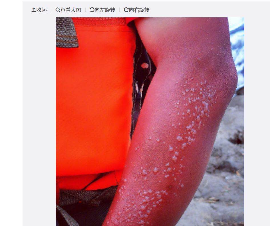 他们不怕晒黑,他们只怕晒伤了会影响救援.