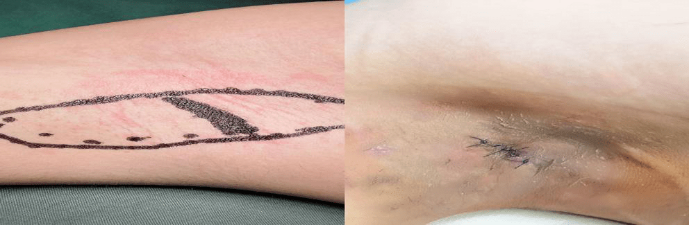 是时候跟腋臭说"再见"了, 让我们清清爽爽上大学!