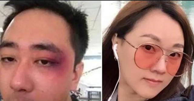 被老婆扇500耳光8次打住院时隔1555天王自健又曝新情况