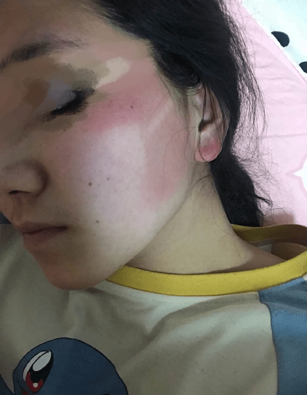 阿裕老师分享:夏季防晒修护