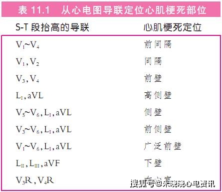 除st段抬高外,心肌梗死的其他心电图特点包括:61 t波对称倒置;61