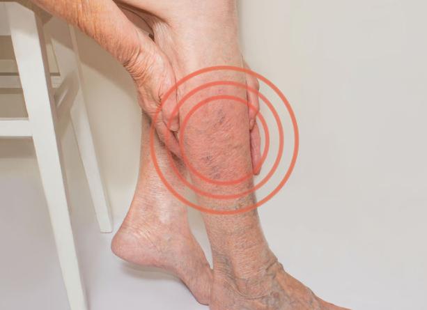 小腿有这几个表现,提醒血液淤积严重或已成栓_手机搜狐网