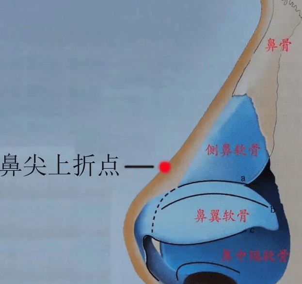 翘鼻尖的标准是:鼻尖上折点和鼻尖点两点连线与鼻背线交角为5-10度